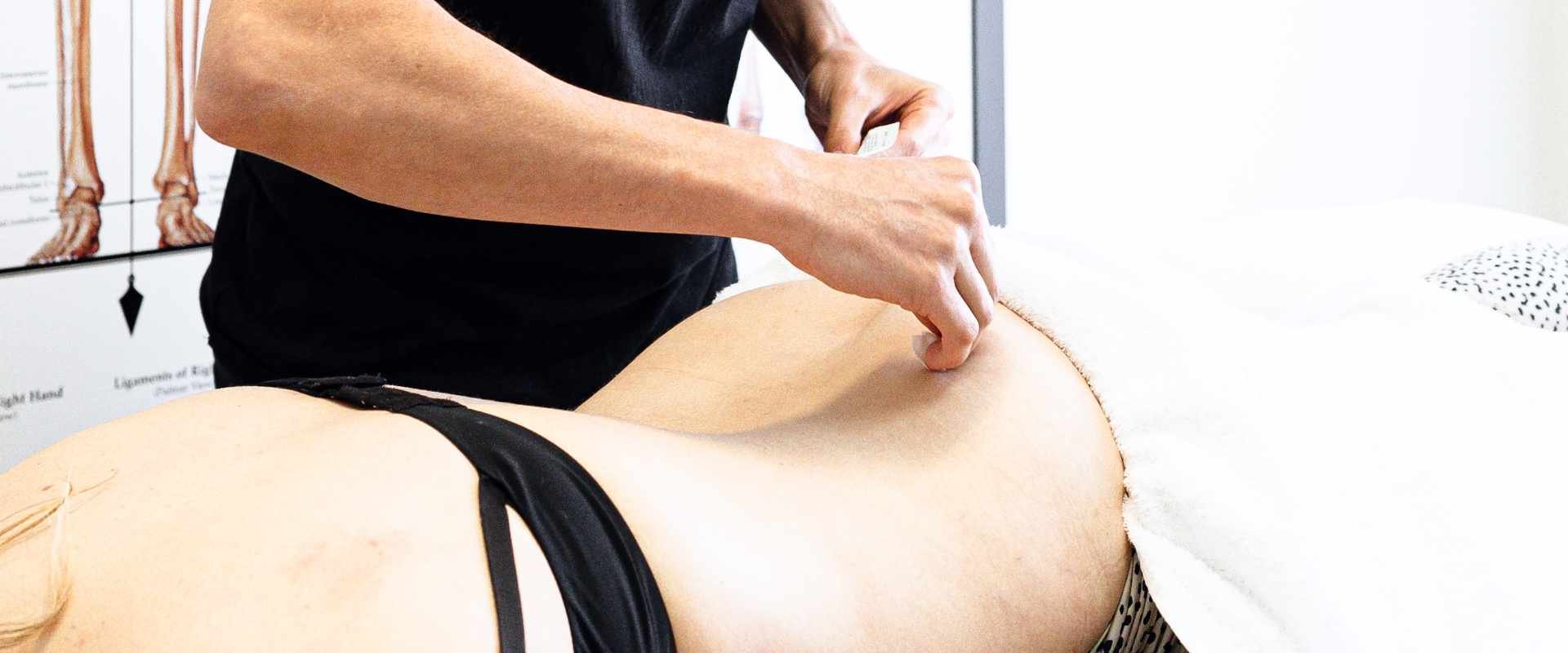 Unlocking Wellness: The Comprehensive Guide to Remedial Massage